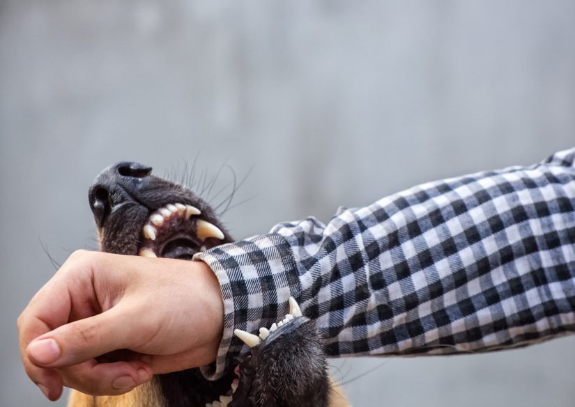 Dog Bite Photo of dog bite